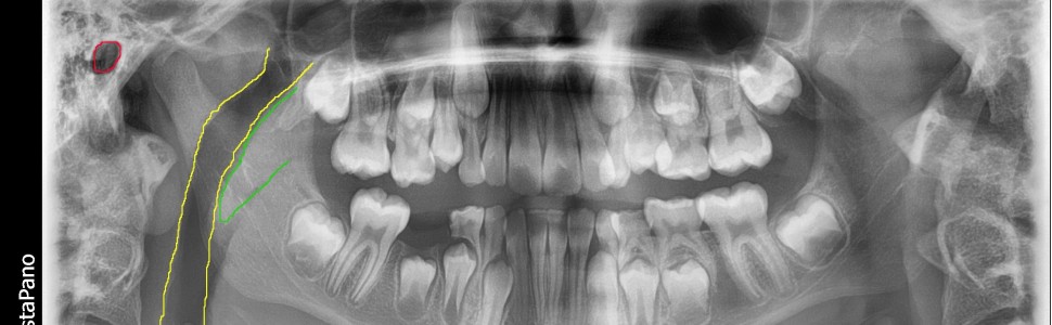 Mały atlas radiologiczny 